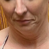 Beautifulpbrbabe Nude